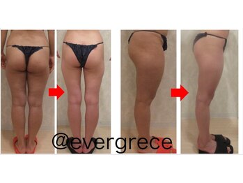 エヴァーグレース 金山店/脚引き締めで美脚を目指せる♪