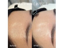 アウル 北千住本店(auL)の雰囲気（無加工でこの違い★フェイスワックス1箇所～セットクーポンあり!）