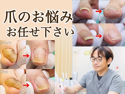 巻き爪補正店 湘南辻堂店の写真