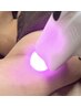 Sugaring×LED【ダブル脱毛】ワキ