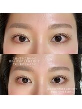 ミテ(mite)/左右対象に