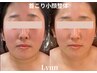 【首こり小顔整体】小顔/首こり/呼吸の浅さ/睡眠 お悩みの方¥12,000→¥10,000