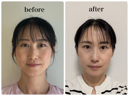 かぐや(salon)の写真