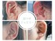 ミアボーテ(MIA BEAUTE)の写真/ハーブパッドで目元を温めながら施術！癒し効果抜群炭酸ヘッドスパでスッキリ眼精疲労、頭痛、小顔効果も◎