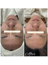 ビースキン(be-skin)/最新肌管理♪