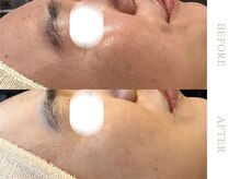 ソワ 恵比寿(soi)/ENVIRONエンビロンフルコース