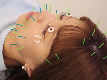 ビゴー鍼灸院 円山院(bigo鍼灸院)の写真/-鍼灸でリフトアップケア-現役講師監修の〈美容鍼〉で始める大人のフェイシャルケア。初めての鍼灸も応援◎