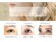 フォルマ(FORMA)の写真