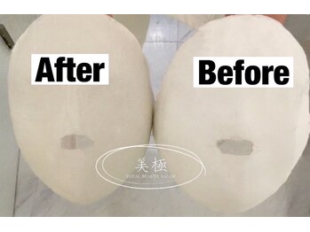 美極 銀座店/銀座/小顔コルギ/小顔矯正