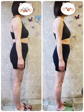 サロンドキー 姫路店(salon de:keY)/３ヶ月で驚きの変化◎