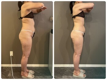 ビクシー(Bixie)/体重を落としたいならこれ!