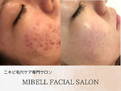 ミベル フェイシャルサロン(MIBELL FACIAL SALON)の写真