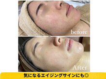 結果重視！お客様のお肌を見極め、あらゆるお悩みにアプローチ