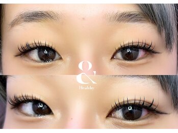 アンジェリック 錦糸町テルミナ店(Angelic)/アンドヘルシー100本