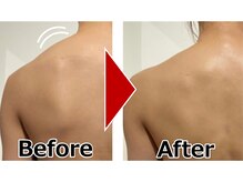 ボディアーキ 吉祥寺店(BODY ARCHI)/【肩こり/冷え】根本改善