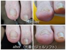 【ジェル人工爪】