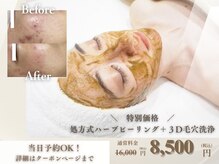 オモテアリ 心斎橋(OmoteAri)