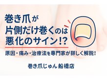 巻き爪じゅん 千葉駅前店/片側だけ巻く片巻きは悪化サイン