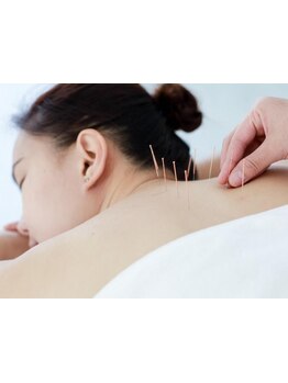 鍼灸施術を受けたい