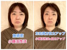 整体眞田流/【目力復活+小顔DRYヘッドスパ】