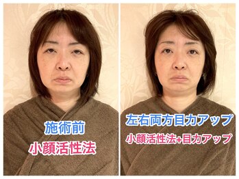 整体眞田流/【目力復活+小顔DRYヘッドスパ】