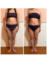 トータル フィルシャイン(Total Fillshine)/本気痩せ全身コース3回