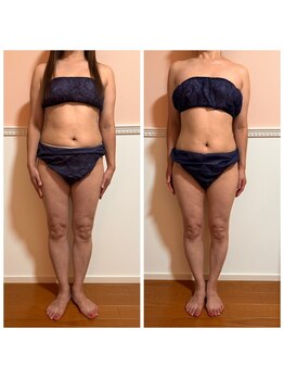 トータル フィルシャイン(Total Fillshine)/本気痩せ全身コース3回