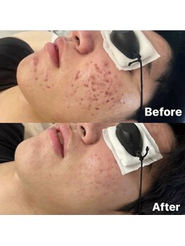 ラティア(Ratia)/