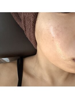 ルシェル(Le.ciel)/ララピール