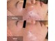 トータルエステサロン ポイント(POINT)の写真