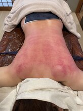 エクセレントビューティーサロン 艶(EN)/筋膜リリース