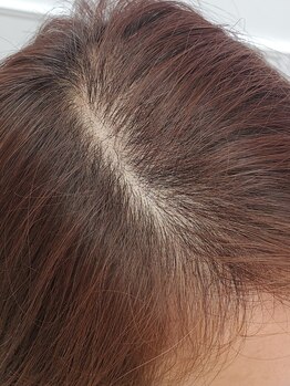 フェアリー 恵比寿店/プロセルセラピーズ頭皮