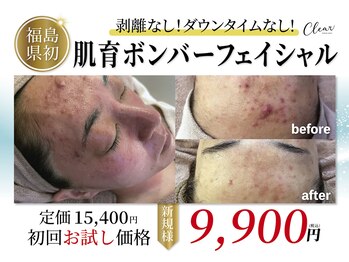 クリア(Clear)の写真/【繰り返す肌荒れに◎】お悩みに徹底アプローチ！ニキビ集中ケアで“できにくい肌”へ★剥離なし◎
