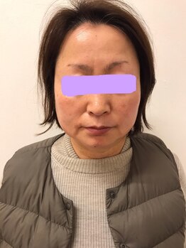 ナノハナ/鹿沼市全身脱毛の美容室ナノハナ