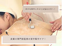 シーズ ラボ 町田店/しつこい背中ニキビを予防