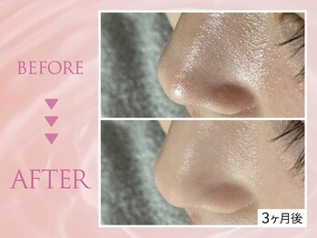 クリアラボ 川崎(Clear Lab)/韓国式肌管理&毛穴洗浄専門店