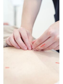 村の整骨院 鍼灸院/