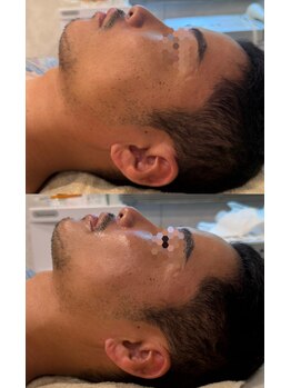 ブリア 横浜(BRILLA)/速攻小顔/肩こりにも◎メンズ◎