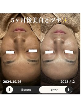 リマイン(Re mine)/くすみ・乾燥肌