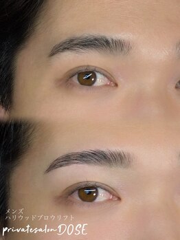 ドース(DOSE)/ハリウッドブロウリフト