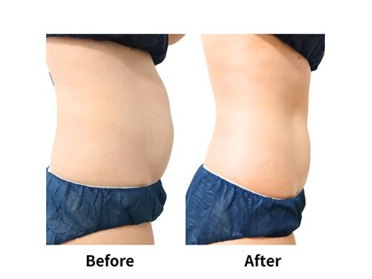 ホワイトビューティーラボ(White Beauty Lab)の写真