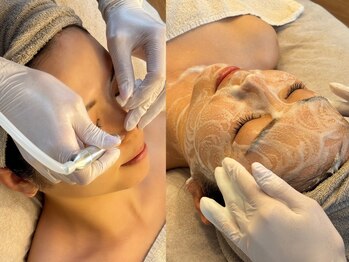 エルピス(ELPIS)の写真/《大阪超希少!!》韓国有名人御用達サロン直伝！【韓国式肌管理】×【毛穴吸引/LED】で極上毛穴ケア◇肥後橋