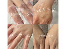 イズム(Izm)/23ハンドケアコース60分