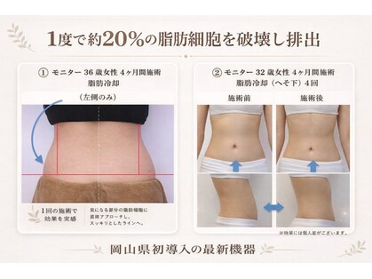 シュシュ(chouchou)の写真