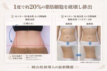 シュシュ(chouchou)