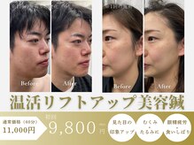 あさひ鍼灸マッサージラボ 成増院