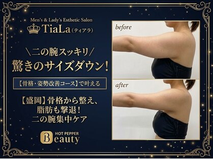 メンズアンドレディース エステティックサロン ティアラ(TiaLa)の写真
