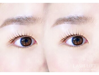 ミイプ(MEPP)/やまもと担ラッシュリフト