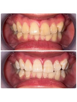 コナホワイトニング 神保町/ホワイトニング御茶ノ水