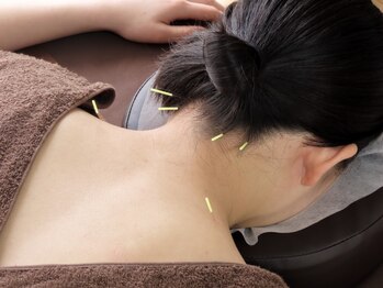 鍼灸院 紡の写真/【春のケア】産後ケアや産後ケア・デスクワークでの肩こり・首の疲れ・眼精疲労・頭痛などの疲労を解消◎